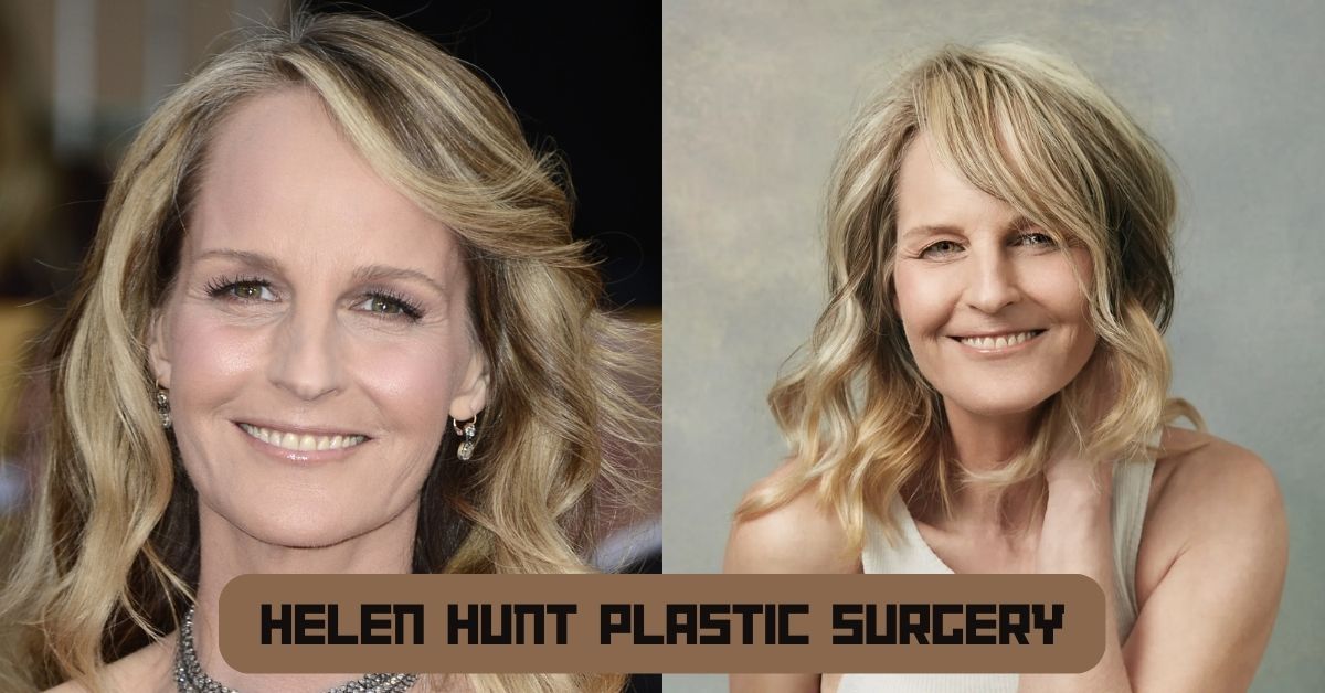 Helen Hunt Plastic Surgery