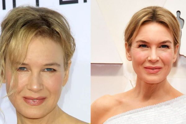 Renee Zellweger Plastic Surgery