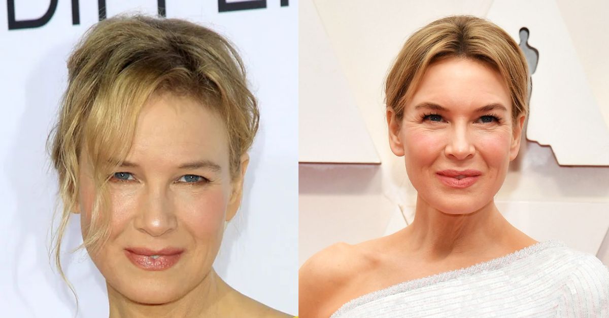 Renee Zellweger Plastic Surgery