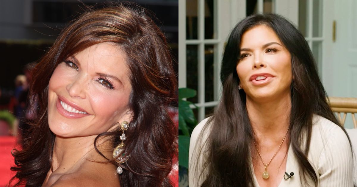 Lauren Sanchez Before Surgery